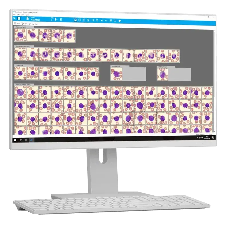 Peripheral Bood Application that accompanies the CellaVision Digital Analyzers